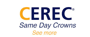 Cerec-toronto-same-day-crowns