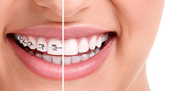 Orthodontics-Toronto