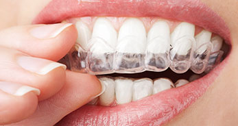 teeth-whitening-tray